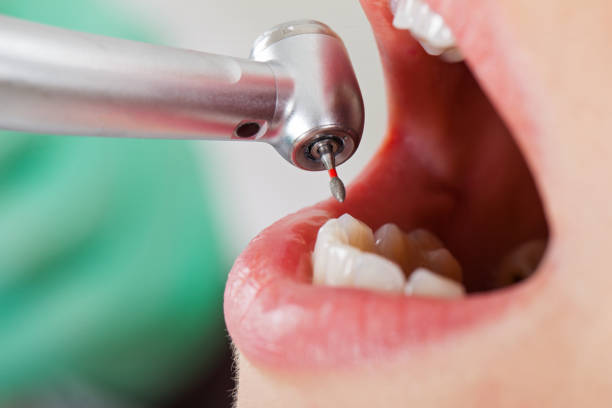 Best Emergency Treatment for Oral Infections in Soh Willard, UT